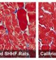 Heart muscle cells in untreated rats bred to develop heart failure show signs of disease. Right: Heart muscle cells remain healthy in rats treated with calcitriol, the hormone that Vitamin D becomes in the body.