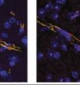 BBB breakdown: The slide at left, below, shows a brain section of a control (non-HIV-infected) mouse following exposure to LPS.  Proteins (stained yellow) lining the BBB exhibit some breaks but are relatively uncompromised. Slide at right shows a brain section of a transgenic mouse (systemically infected with HIV) following exposure to LPS. Here the combination of HIV infection and LPS exposure has severely fragmented the proteins lining the BBB.