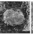 Bacillus anthracis spores as viewed in SEM (left) and TEM (right).