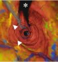 OFDI fly-through view of same patient's right coronary artery, white arrowheads indicate area of white dotted line in image at right.