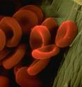Scientists at Penn State used red blood cells from a mouse to study the evolution of gene regulation. The research is expected to help other researchers to develop drugs to treat people who suffer from sickle-cell anemia and other blood disorders.