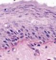 A cross-section through artificial skin (left) compared to section through human skin (right). Both the natural and the artificial skin are made up of three layers.