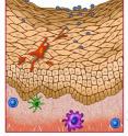 This illustration shows how the HIV virus slips between loosely connected skin cells to reach its immune cell targets such as the Langerhans cells (orange), macrophages (purple), dendritic cells (green) and CD4 positive T cells (blue).