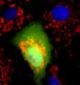 Expression of a small fragment of p115 (green) leads to Cytochrome C (red) release in cells causing cell death.