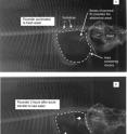 Freshwater fish drink very little, while most marine fish ingest copious amounts of seawater to maintain salt and water balance. The European flounder is euryhaline and illustrates that no intestinal calcium carbonate is formed in freshwater (Figure A) and only a brief period in seawater results in the formation of x-ray opaque calcium carbonate precipitates in the intestinal lumen (Figure B). The calcium carbonate precipitates are formed regardless of feeding and are excreted to the surrounding seawater, where it impacts the pH balance.