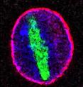 In aging cells one of the proteins composing nuclear pores becomes damaged and molecules that should be restricted to the cytoplasm invade the nucleus (outline shown in red). In particular, a protein called tubulin (shown in green), which is strictly a cytoplasmic protein, shows up as long filaments that co-opt a large part of the nucleus.