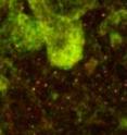 Fragile X granules (red dots) appear beside neuron cell bodies (green) in microscopy of mouse brain tissue. The granules could be useful as targets for new therapies in autism and mental retardation.