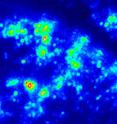 This image shows the same portion of a beetle scale as the previous image. However, this image was made by a fluorescence microscope using a new method. A mirror-like plate containing silver nanoparticles was placed beneath the scale, and an infrared laser excited the silver nanoparticles so they act as beacons of white light. The spots in the image are places where the light passed through the scale, providing researchers with information about the scale's internal structure. Almost no light from the beacons passes through the thickest part of the shell (black shadow in upper right) that was the brightest area using a conventional fluorescence microscope.