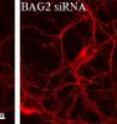 These are images of neurons in culture.