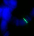 In this photo chromosome strands are aligned in a wild type fly.