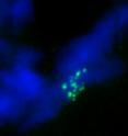 This photo shows chromosome strands misaligned without linker histone H1 in a
fly with reduced H1 levels -- H1KD.