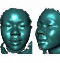 These are three-dimensional images of a face with location points indicated.