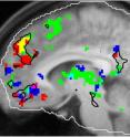 When people are familiar with a tune, their brains show increased
activity in the regions shaded in green in this fMRI image. Red areas
respond to salient autobiographical memories, and blue areas respond to
tunes that a person enjoys. The brain region known as the dorsal medial
prefrontal cortex responds both to familiarity and autobiographical
associations (yellow).