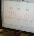 A computer screen shows the electrical activity of a specialized heart cell called a sinoatrial nodal cell. This type of cell can beat on its own without electrical stimulation, allowing scientist to see its activity when extracted. Information gleaned is contributing to understanding heart-pacing changes that occur during the body's "fight or flight" response to stress.