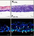 Organotypic cultures reveal how the transcription factor PPAR&#946;/&#948; modulates the fi broblasts’
response to keratinocyte-released IL-1. Fibroblasts lacking either PPAR&#946;/&#948; or its transcriptional
target, sIL-1ra (an inhibitor of IL-1 signaling; right panels), overproduce growth factors that induce
the overlying keratinocytes to proliferate excessively (arrows).