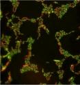 This is a magnification of <i>E. coli</i> exposed to a low concentration (10 mg/L) of titanium dioxide nanoparticles. Cells with compromised membranes are stained red.