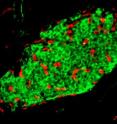 This is an adult mouse islet cell (insulin in green; endothelial marker Meca-32 in red).