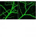 There are fewer pathways (green strands) for information to flow between neurons in the brain of a mouse bred to exhibit symptoms of schizophrenia compared to a normal mouse. Fewer pathways make it hard for information to flow between neurons and results in the symptoms of schizophrenia