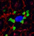 Macrophages (green) are shown attaching to a metastatic tumor cell (blue) in the lung -- a process that promotes metastatic growth.