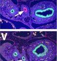 This shows normal and separate expression of Nkx2.1 (green) in lung endoderm and p63 (red) in esophagus endoderm (arrow) (Panel U).  Activation of Wnt/beta-catenin results in reprogramming of esophagus endoderm to Nkx2.1 positive lung endoderm (panel V, arrow).