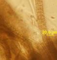 An image of the source cyanobacteria assemblage for hoiamide A as seen under the microscope.