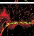 In the top image an inert red dye injected into the circulation of normal mice remains confined within blood vessels (green) of the brain.  Whereas in the bottom image the same red dye injected into the circulation of mice with a 50 percent reduction in the level of Protein S leaks out of brain vessels (green), and leaches into the surrounding brain tissue.