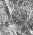 A little-known bacterial species called segmented filamentous bacterium, or SFB, can activate the production of specialized immune cells in mice. This scanning electron microscope image of an SFB colony shows a mass of long hair-like filaments created when the bacteria stay attached to each other after they divide.