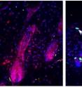 Hair follicle regeneration by undamaged cells (red, left panel) is delayed by the presence of damaged cells (arrows, right panel).  Damaged cells are maintained because of the absence of p53 (right panel).