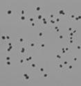 Pneumococcus colonies (as seen here) ordinarily must be counted manually to determine whether pneumonia vaccine is effective on a patient.  The NICE software from NIST automates the process.