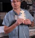 Dr. Paul Fedak from the University of Calgary Faculty of Medicine has developed an innovative method to repair the breastbone after it is intentionally broken to provide access to the heart during open-heart surgery. The technique uses a state-of-the-art adhesive that rapidly bonds to bone and accelerates the recovery process