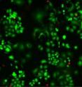 These photomicrographs demonstrate the dramatic impact of using nanotubes to selectively locate and destroy HER2 breast cancer tumors. Tumor cells on the left were treated only with antibodies against the HER2 protein and then irradiated with near-infrared light. Those on the right were treated with a complex of antibodies and nanotubes and then irradiated. Both cultures then were stained with fluorescent dye -- green color indicates live cells while red marks areas where cell have been killed.