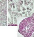 These microscopy images show the cellular reprogramming uncovered by EMBL scientists. On the left is an ovary of a normal adult female mouse, with a close-up (top left) showing the typical female granulosa cells. When the Foxl2 gene was silenced in these cells (right, top right: close-up), they took on the characteristics of Sertoli cells, the cells normally found in testes of male mice.