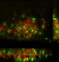 TB bacteria infect host macrophages in a larval zebra fish and prod epithelial cells to produce MMP9, a signaling protein associated with worsening infection. The MMP9 stained green in this mount, while the macrophages in the tubercle stained red, showing that macrophages don't produce MMP9.