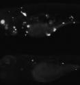 The top panel shows a zebrafish larva that has been infected with fluorescent TB bacteria. Single infected macrophages, and macrophages that have aggregated into granuloma (TB tubercles) can been seen. Inhibiting the production of MMP9 (bottom panel) reduces granuloma formation and bacterial burdens.