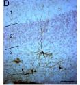 This is a single stem cell-derived neuron that has migrated away from the transplantation site in the cortex and grown into a mature neuron. The blue stain shows the nuclei of the endogenous neural cells in this part of the brain.