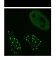 When cells with DNA damage are infected with HSV-1 virus (top image, virus shown in red) the viral ICP0 protein prevents the DNA repair proteins (bottom image, DNA repair proteins shown in green) from accumulating at sites of DNA damage.