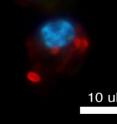 This is bacteria (<i>Streptococcus pneumoniae</i>, red) under attack by a neutrophil (blue).