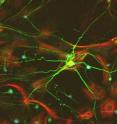 This photo shows neurons (green) and astrocytes (red) grown in culture. Astrocytes have become a hot research topic as evidence mounts suggesting that astrocytes in the brain’s cortex do more than provide support to neurons. UC San Diego bioengineers recently found that amyloid beta peptides (A&#946;) spontaneously trigger calcium waves in purified cultures of astrocyte cells extracted from the cortex region of rat brains and grown in the lab. These calcium waves could be relevant for understanding the origin of Alzheimer's disease.