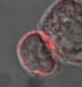 T lymphoycte cell (small cell with red surface) scanning another cell for the presence of foreign molecules.