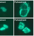 The figures show that fulvestrant-mediated cytoplasmic localization of ER is associated with intermediate filament proteins CK8 and CK18. After treatment of MCF-7 and T47D cells (breast cancer cells) with fulvestrant, dramatic cytoplasmic localization of ER was observed. The results indicate that the presence of CK8 and CK18 is necessary for fulvestrant-induced cytoplasmic localization of ER, which keeps the receptor away from the nucleus where it could activate growth promoting genes.