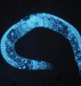 The discovery of a novel cellular "switch" in the popular laboratory research worm, <I>C. elegans</I> by a University of Colorado at Boulder team may provide researchers with a new means of triggering programmed cell death in humans to treat disease.