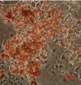 These are fat cells (dyed orange) produced in a lab setting by Prof. Amit Gefen.