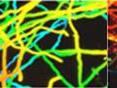 This is a confocal microscope image of fungal biofilm without (left) or with (right) treatment by bacteria.