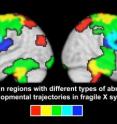 This composite image, created by Stanford researchers Fumiko Hoeft and Allan Reiss, shows the difference in growth of brain regions from first measurement to second measurement in study participants with Fragile X compared to controls. Areas in green grew in volume faster in Fragile X than controls. Areas in red started off large in Fragile X at time 1 and remained large at time 2, and areas in blue started off small in Fragile X at time 1 and remained small at time 2.