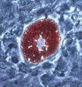 This is a mature fat cell.