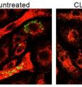 This image shows novel therapeutic protects against multiple bacterial pathogens.