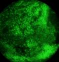Researchers can easily distinguish cancer cells from healthy cells in photos of tissue samples taken with a $400 Olympus E-330 camera. The images are captured with a fiber-optic cable. The tip of the cable, which is about as wide as a pencil lead, can be applied directly to the inside of the cheek.