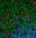 Reed-Sternberg cells can be distinguished by their red outline, blue and white internal staining, and their lack of green staining.