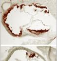 Early areas of atherosclerosis (seen using a red stain that identifies fat) line the artery walls of a mouse fed a high-fat diet (top image), while much less disease is seen in a mouse fed a high-fat diet but unable to make fatty acid synthase in macrophages (bottom image).