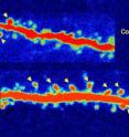 The bottom slide shows regeneration of synaptic connections in group
receiving ketamine, compared to control group.